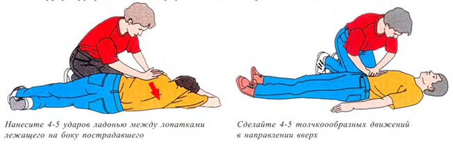 Как уложить пострадавшего при потере сознания