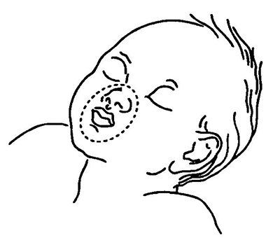 Методика «дыхание рот в рот и нос» у младенца