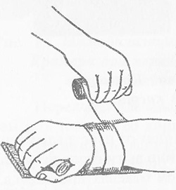 Иммобилизация шиной Крамера при переломах кости предплечья в нижней трети